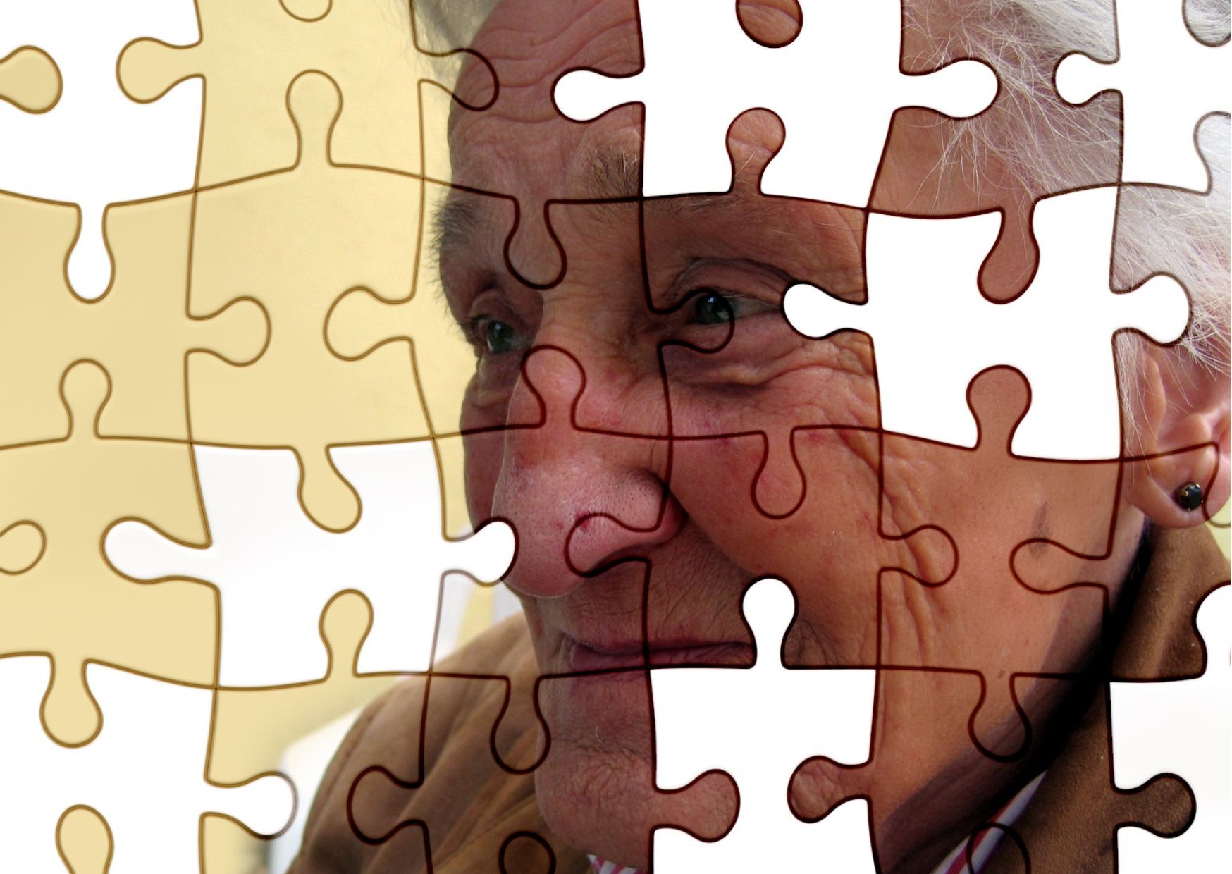 Memory Matters: Exploring the Spectrum of Dementia